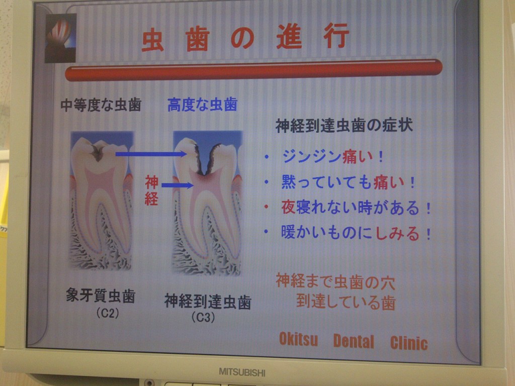 Otaru-Shi-20120818-00133
